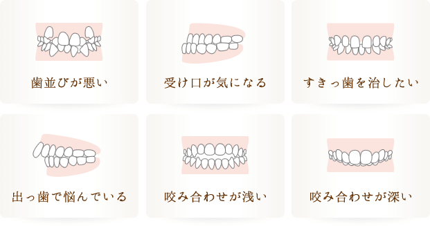 こんな症状で困っていませんか？「デコボコしている」「受け口が気になる」「すきっ歯を治したい」「出っ歯で悩んでいる」「口が閉まらない」「咬み合わせが深い」